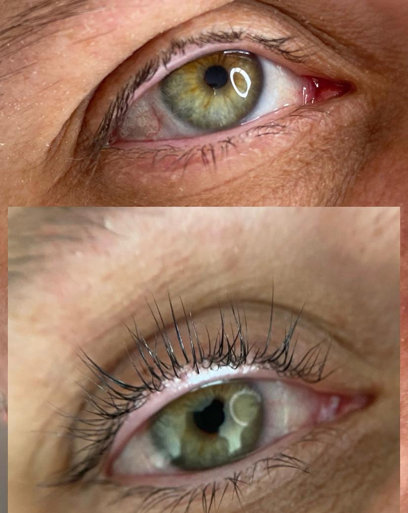 Lifting de pestañas